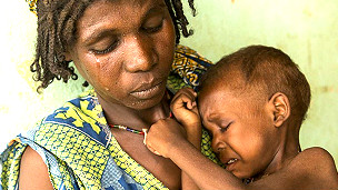 Video porno konvulsiyalar