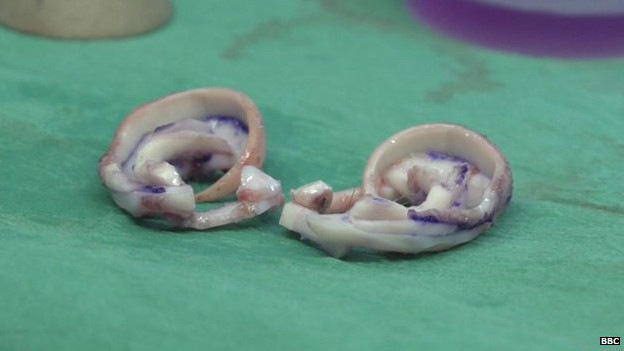 Уши из хрящей