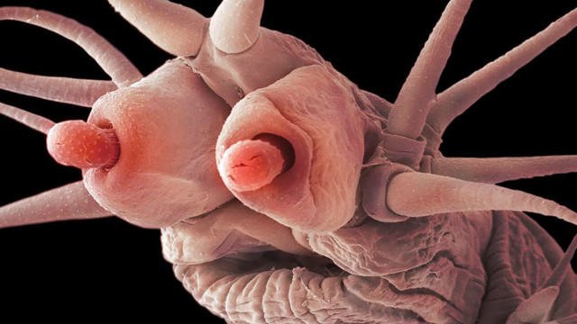 Ajablanarli darajada katta klitorisli porno videolar