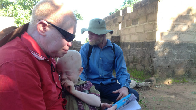 Komunitas albino di Tanzania