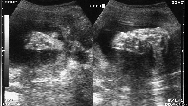 Panties va taytlardagi erotizm