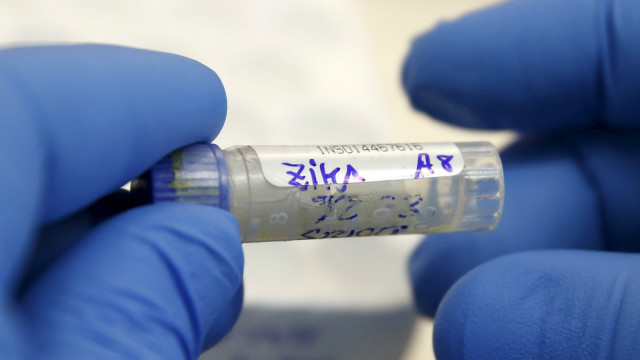 Yalangoch fotosuratlar