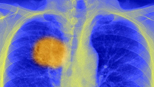 Saraton va uloqcha jinsiy muvofiqligi