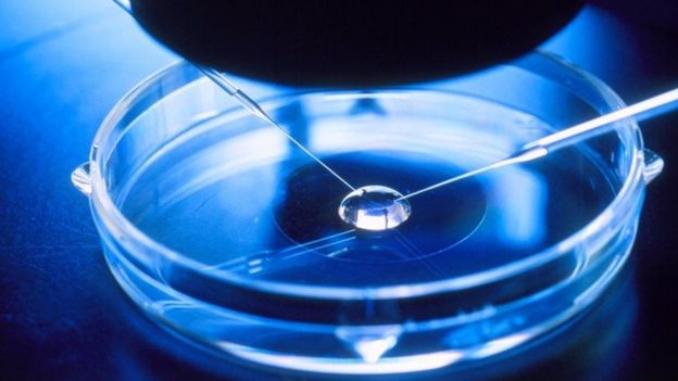 IVF