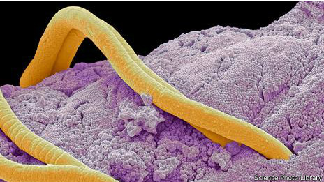 Parásito intestinal